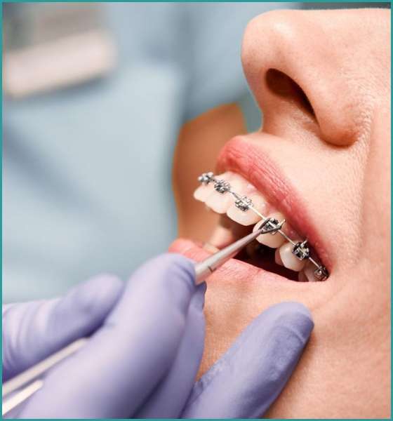 Orhtodontist in South Dlehi