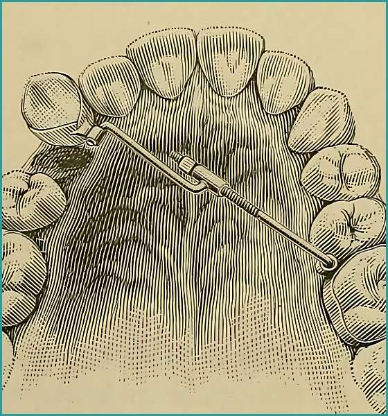 History of Orthodontics