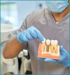 Dental Implants in south delhi