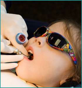 pediatric dentistry in south delhi