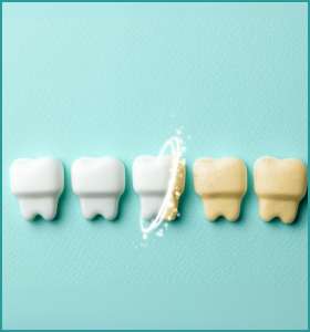 Who can opt for teeth whitening