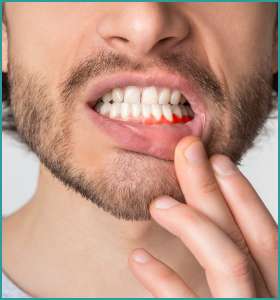 Teeth whitening disadvantages