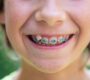 Does Your Child Need Braces 90x80