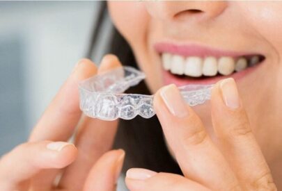 Invisalign in Punjabi Bagh