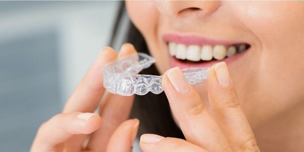 Invisalign in Punjabi Bagh