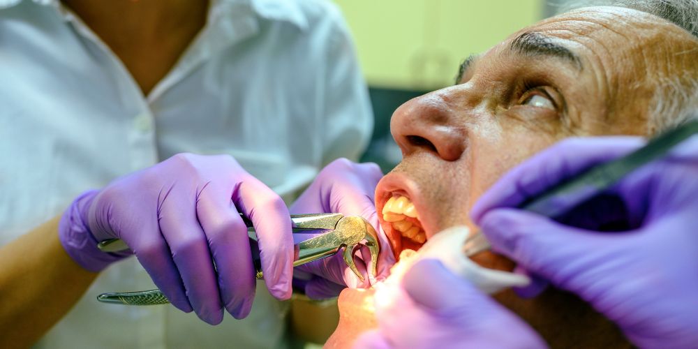 Wisdom Tooth Extraction in West Delhi