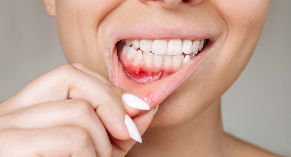 gum treatment in west delhi