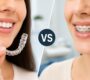 Invisalign vs Traditional Braces 90x80